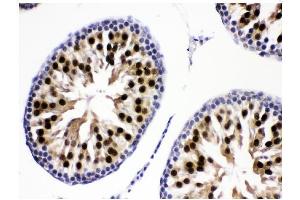 IHC analysis of KDM5B using anti-KDM5B antibody (ABIN4886648). (KDM5B Antikörper  (Middle Region))