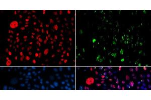 Immunofluorescence analysis of GFP-RNF168 transgenic U2OS cells using Phospho-SMC1A(S957) Polyclonal Antibody (SMC1A Antikörper  (pSer957))