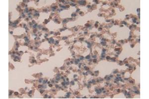 IHC-P analysis of Mouse Lung Tissue, with DAB staining. (Retinoic Acid Receptor alpha Antikörper  (AA 237-459))