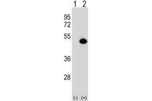 Western Blotting (WB) image for anti-Argininosuccinate Synthase 1 (ASS1) (AA 281-310) antibody (ABIN3030021)