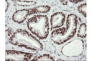 Image no. 17 for anti-Transducin-Like Enhancer of Split 1 (E(sp1) Homolog, Drosophila) (TLE1) (AA 180-460) antibody (ABIN1491050)