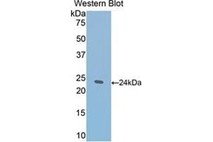 Western Blotting (WB) image for Thrombospondin 1 (THBS1) ELISA Kit (ABIN6574175)
