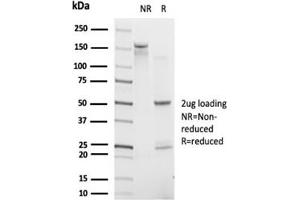 SDS-PAGE Analysis. (IRF9 Antikörper)
