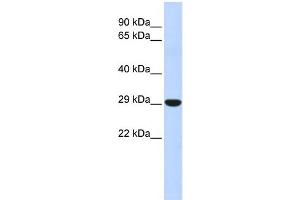 WB Suggested Anti-HOXB8 Antibody Titration: 0. (HOXB8 Antikörper  (N-Term))