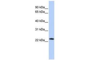 Image no. 1 for anti-Stromal Cell Derived Factor 2 (SDF2) (C-Term) antibody (ABIN6741043) (SDF2 Antikörper  (C-Term))