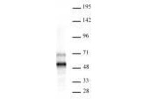MEIS 1/2/3 antibody (rAb) tested by Western blot. (Rekombinanter MEIS1/MEIS2/MEIS3 (AA 59-390) Antikörper)
