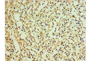 Immunohistochemistry of paraffin-embedded human spleen tissue using ABIN7151129 at dilution of 1:100 (RNF125 Antikörper  (AA 1-232))