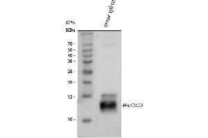 Western blot analysis of PF4 using anti-PF4 antibody (ABIN4886693). (PF4 Antikörper  (AA 30-105))