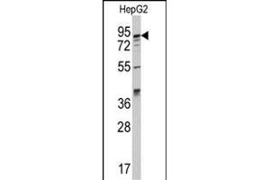 Western blot analysis of anti-K1 Antibody (C-term) (ABIN392338 and ABIN2841979) in HepG2 cell line lysates (35 μg/lane). (AAK1 Antikörper  (C-Term))