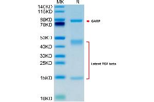 Human GARP(Y137H&S138G&G139N)&Latent TGF Beta Complex on Tris-Bis PAGE under reduced condition.