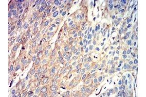 Immunohistochemistry (IHC) image for anti-ATG3 Autophagy Related 3 (ATG3) (AA 1-100) antibody (ABIN5611290)