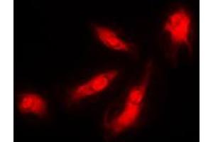 Immunofluorescent analysis of p35 staining in HeLa cells. (CDK5R1 Antikörper  (N-Term))