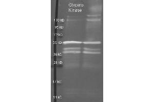 Goat anti Glycerol Kinase antibody  was used to detect purified Glycerol Kinase under reducing (R) and non-reducing (NR) conditions.