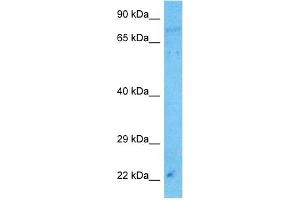 Western Blotting (WB) image for anti-Sad1 and UNC84 Domain Containing 1 (SUN1) (N-Term) antibody (ABIN2783971)