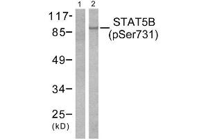 Western Blotting (WB) image for anti-Signal Transducer and Activator of Transcription 5B (STAT5B) (pSer731) antibody (ABIN1847250) (STAT5B Antikörper  (pSer731))