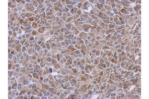 IHC-P Image Immunohistochemical analysis of paraffin-embedded RT2 xenograft, using DLST, antibody at 1:500 dilution. (DLST Antikörper  (Center))