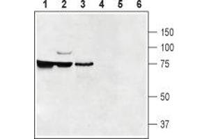 Western blot analysis of rat kidney (lanes 1 and 4), mouse brain (lanes 2 and 5) and rat testis (lanes 3 and 6): - 1-3.