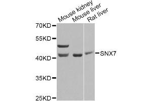 Western blot analysis of extracts of various cell lines, using SNX7 Antibody. (Sorting Nexin 7 Antikörper)