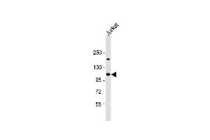 Anti-UBL Antibody (Center) at 1:1000 dilution + Jurkat whole cell lysate Lysates/proteins at 20 μg per lane.