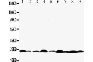 Western blot analysis of Bax using anti- Bax antibody .
