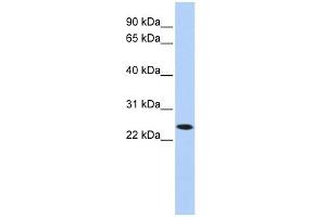 KLRA1 antibody used at 1 ug/ml to detect target protein.