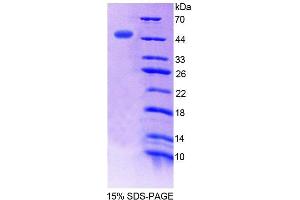SDS-PAGE (SDS) image for Exoribonuclease 1 (ERI1) (AA 2-249) protein (His tag) (ABIN4989743) (ERI1 Protein (AA 2-249) (His tag))
