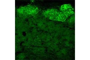 IF on rat olfactory bulb using Mouse monoclonal antibody to rat p75NTR  at a concentration of 10 µg/ml.