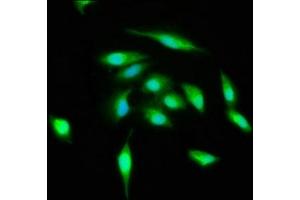 Immunofluorescence staining of Hela cells with ABIN7174567 at 1:400, counter-stained with DAPI. (ATG3 Antikörper  (AA 1-314))