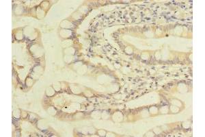 Immunohistochemistry of paraffin-embedded human small intestine tissue using ABIN7162550 at dilution of 1:100 (ZDHHC3 Antikörper  (AA 94-171))