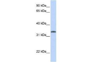 UCK2 antibody used at 1 ug/ml to detect target protein. (UCK2 Antikörper  (N-Term))