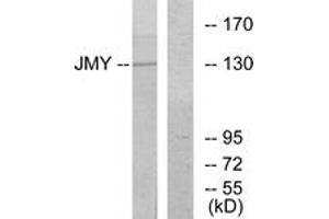 Western blot analysis of extracts from COLO cells, using JMY Antibody. (JMY Antikörper  (AA 931-980))