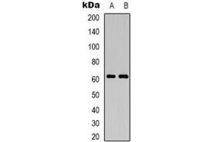 Western blot analysis of CD19 expression in Jurkat (A), mouse brain (B) whole cell lysates. (CD19 Antikörper)
