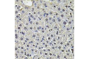 Immunohistochemistry of paraffin-embedded mouse liver using SP110 Antibody (ABIN6290941) at dilution of 1:100 (40x lens). (SP110 Antikörper)