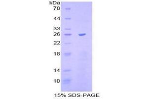 SDS-PAGE analysis of Mouse Caspase 11 Protein. (Caspase 4 Protein)