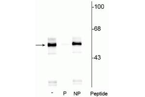 Western blot of rat brainstem lysate showing specific immunolabeling of the ~55 kDa TPH protein phosphorylated at Ser260 in lane one (-). (Tryptophan Hydroxylase 1 Antikörper  (pSer260))