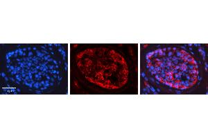 Rabbit Anti-PRKCZ Antibody   Formalin Fixed Paraffin Embedded Tissue: Human Testis Tissue Observed Staining: Cytoplasm Primary Antibody Concentration: 1:600 Other Working Concentrations: N/A Secondary Antibody: Donkey anti-Rabbit-Cy3 Secondary Antibody Concentration: 1:200 Magnification: 20X Exposure Time: 0.