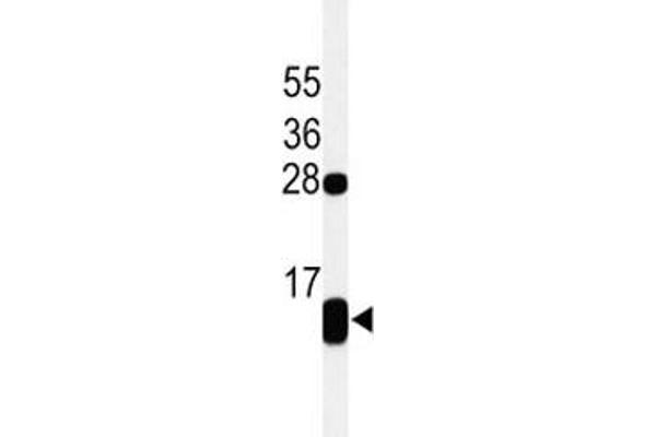 Phospholamban Antikörper  (AA 1-30)