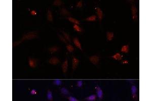 Immunofluorescence analysis of NIH/3T3 cells using c-Fos Polyclonal Antibody at dilution of 1:100. (c-FOS Antikörper)
