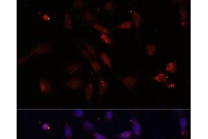 Immunofluorescence analysis of NIH/3T3 cells using c-Fos Polyclonal Antibody at dilution of 1:100. (c-FOS Antikörper)