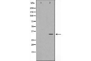 Western blot analysis on HuvEc cell lysate using C/EBP-epsilon Antibody. (CEBPE Antikörper  (Internal Region))