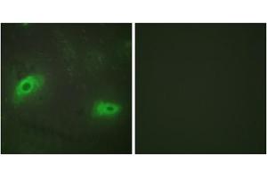 Immunofluorescence analysis of HeLa cells, using TNFSF9 antibody. (TNFSF9 Antikörper  (Internal Region))