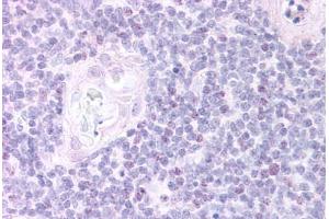 Human Thymus, Medulla (formalin-fixed, paraffin-embedded) stained with FOXN1 antibody ABIN297057 at 20 ug/ml followed by biotinylated anti-goat IgG secondary antibody ABIN481715, alkaline phosphatase-streptavidin and chromogen. (FOXN1 Antikörper  (AA 635-648))