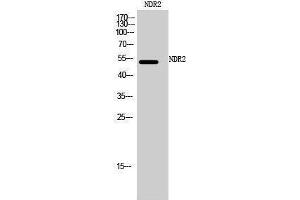Western Blotting (WB) image for anti-serine/threonine Kinase 38 Like (STK38L) (C-Term) antibody (ABIN3185788) (STK38L Antikörper  (C-Term))