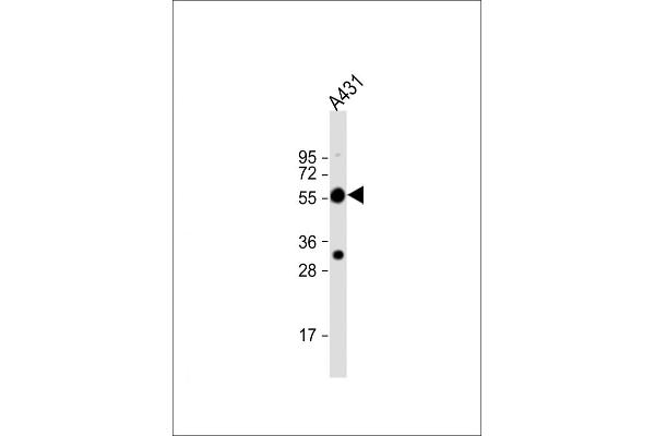 TUBA1C anticorps  (C-Term)