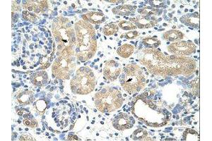 Image no. 1 for anti-Ribonucleoprotein, PTB-Binding 1 (RAVER1) (AA 24-73) antibody (ABIN202804) (RAVER1 Antikörper  (AA 24-73))
