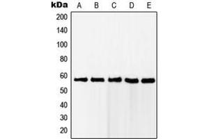 Western blot analysis of RAB11FIP2 expression in Jurkat (A), HeLa (B), MCF7 (C), A431 (D), HEK293 (E) whole cell lysates. (RAB11FIP2 Antikörper  (Center))