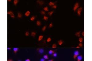 Immunofluorescence analysis of A431 cells using ACVR2A Polyclonal Antibody at dilution of 1:100 (40x lens). (ACVR2A Antikörper)