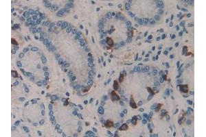 DAB staining on IHC-P; Samples: Human Stomach Tissue (HSF4 Antikörper  (AA 171-284))