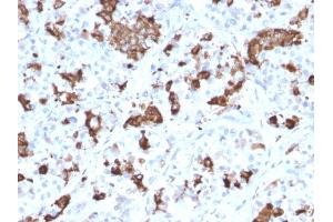 Formalin-fixed, paraffin-embedded human Pituitary stained with Prolactin Mouse Monoclonal Antibody (PRL/2644). (Prolactin Antikörper  (AA 63-201))