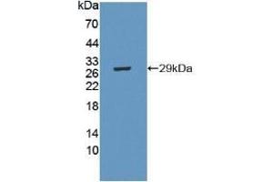 Detection of Recombinant CRISP1, Mouse using Polyclonal Antibody to Cysteine Rich Secretory Protein 1 (CRISP1) (CRISP1 Antikörper  (AA 20-244))